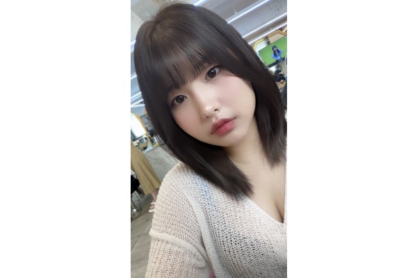 v라인윤곽술,심술보제거,이마필러 했어용