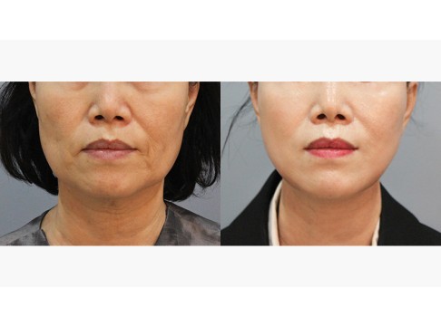 안면목거상+집업거상