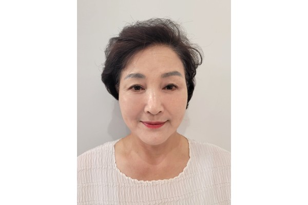 하안검, 안면목거상,눈위필러 했어요