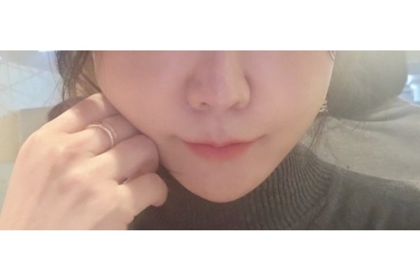 실리프팅으로 리프팅!