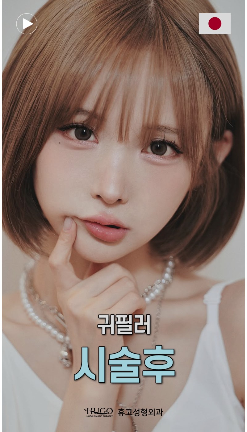 일본 인플루언서 특유의 '인형 미모' 비결, 귀필러였어?????(feat. そんあみ)