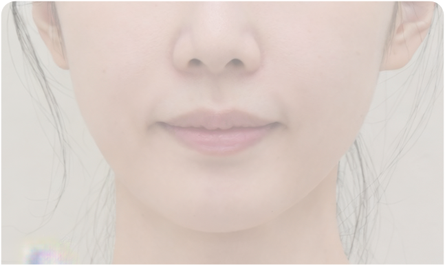 높은 헤어라인으로 어색한 얼굴 비율
