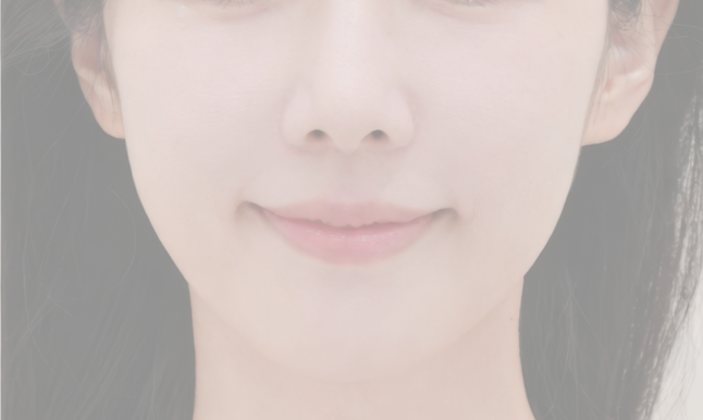 수술 후 예시 3