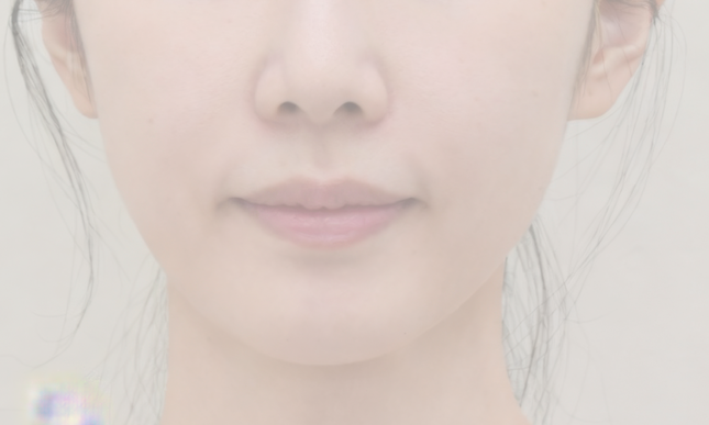 수술 전 예시 1