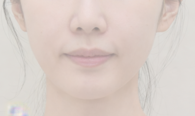 수술 전 예시 3