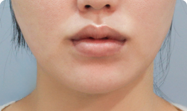 Rectangle 10
